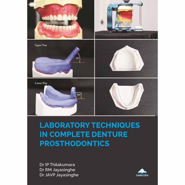 Laboratory Techniques in Complete Denture Prosthodontics